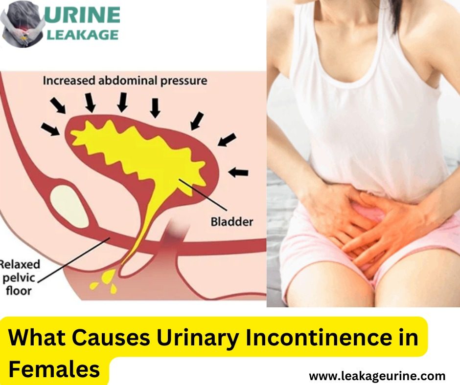 What Causes Urinary Incontinence in Females?