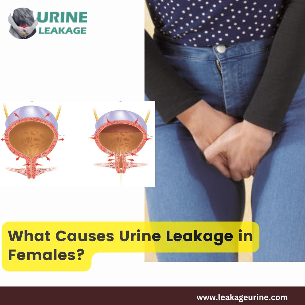 What Causes Urine Leakage in Females?